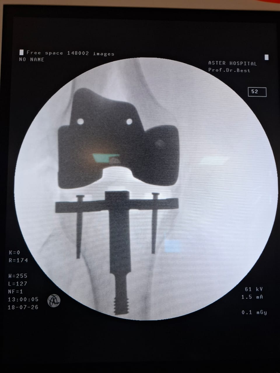 Knee X-ray 15