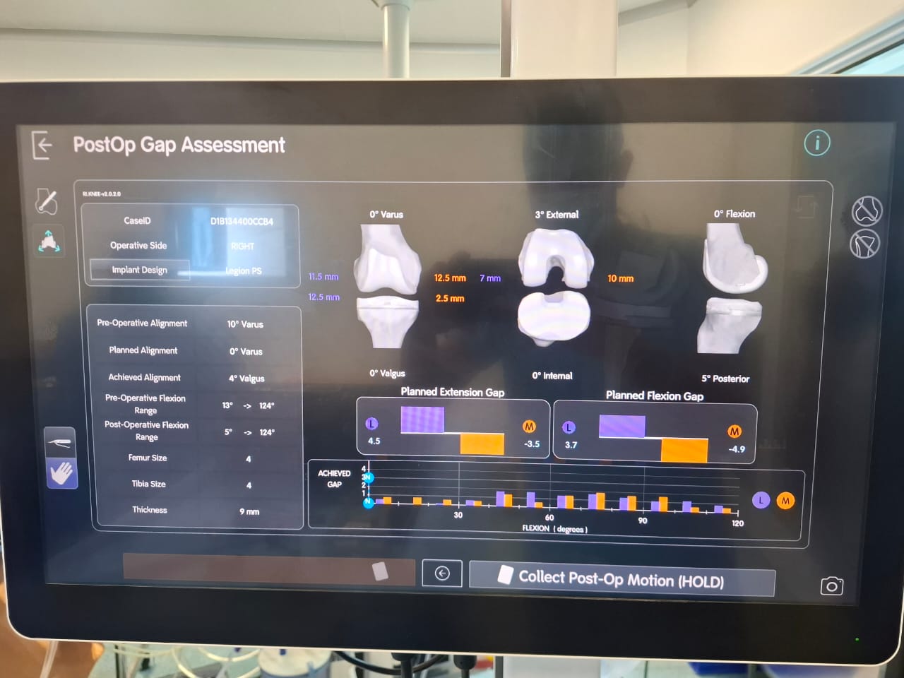 Knee X-ray 17