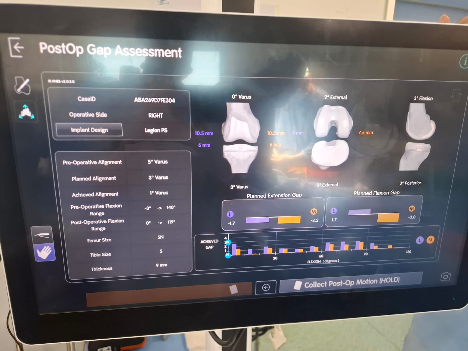 Knee X-ray 19