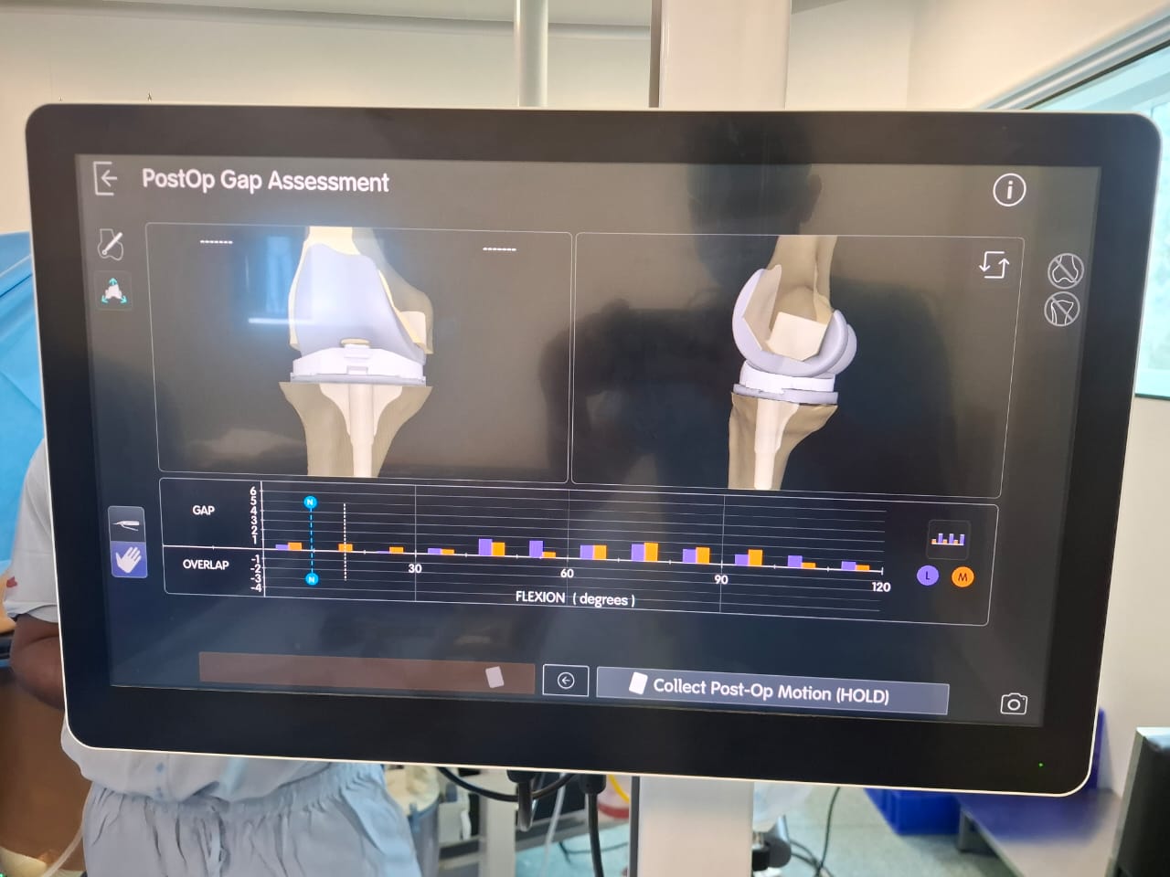 Knee X-ray 2