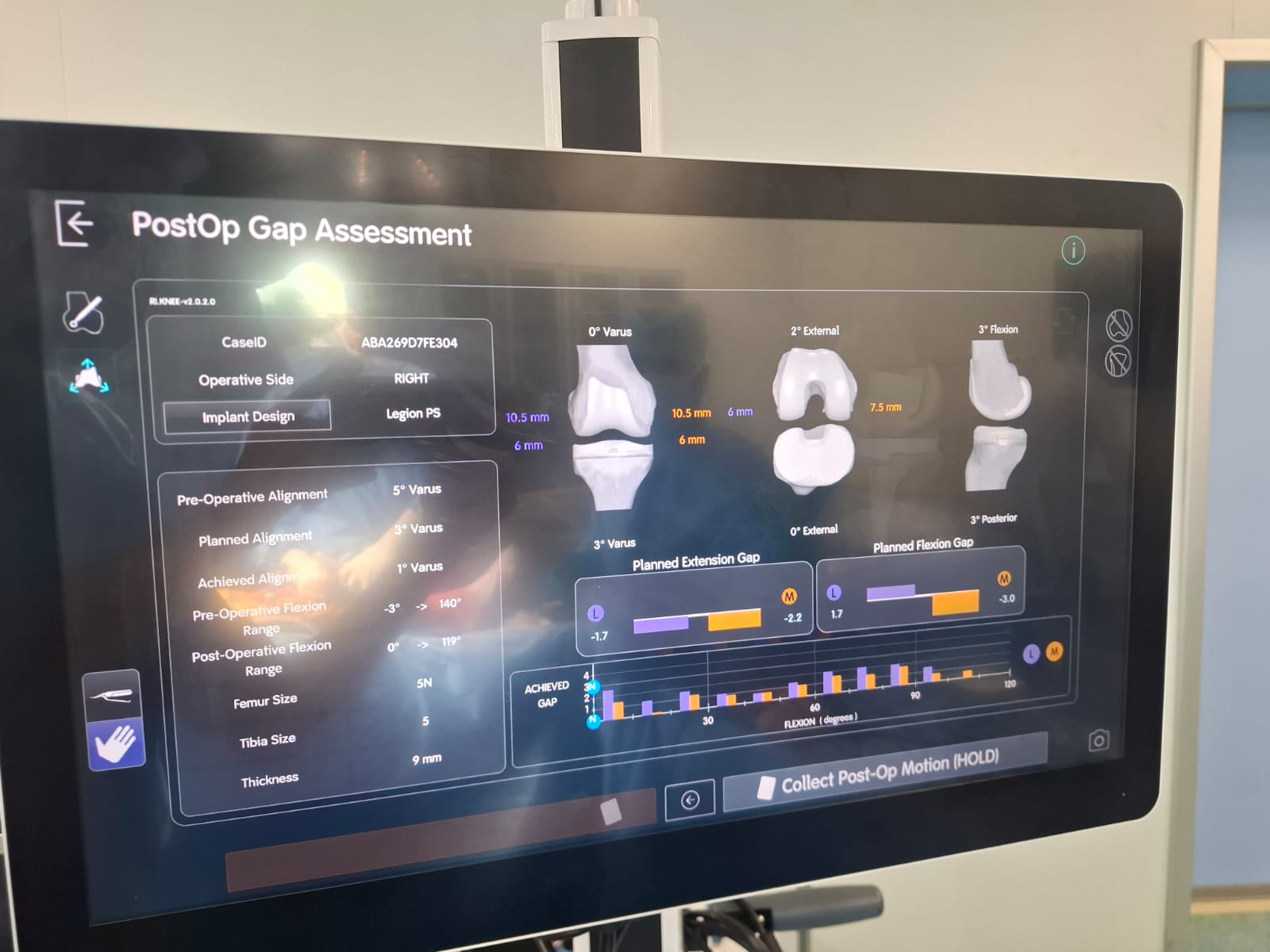 Knee X-ray 20