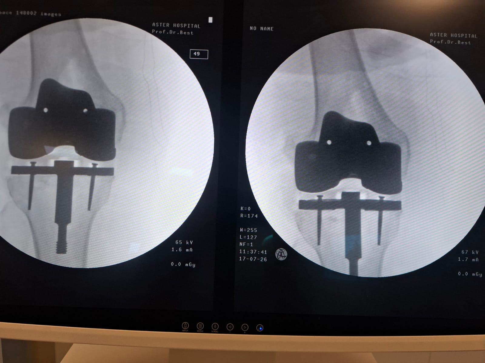 Knee X-ray 21