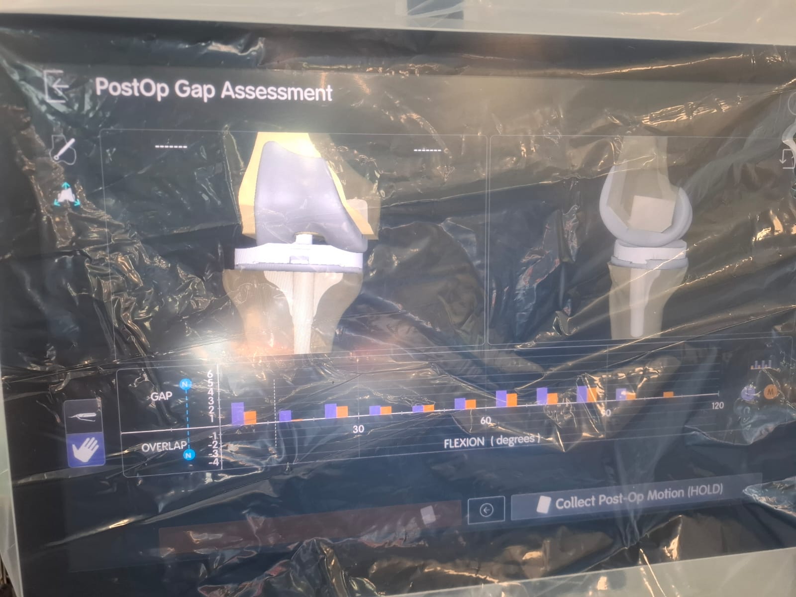 Knee X-ray 27