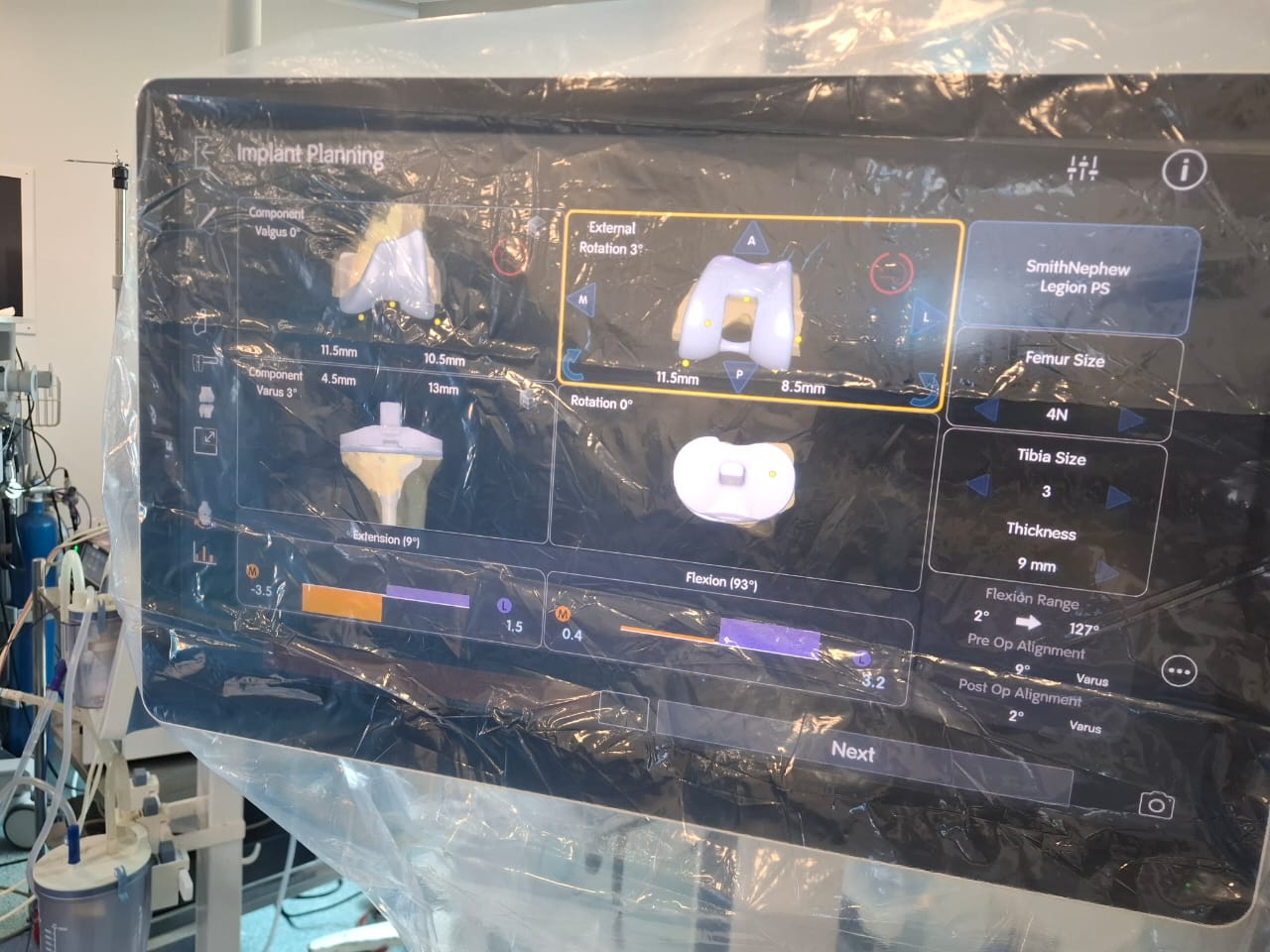 Knee X-ray 29