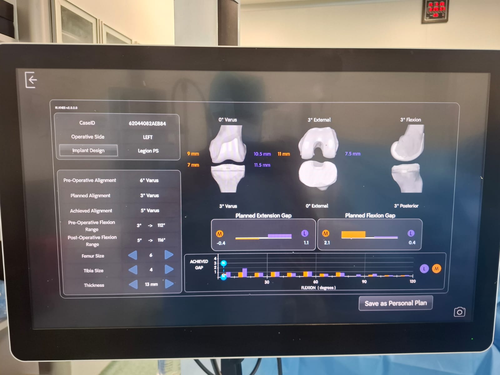 Knee X-ray 31