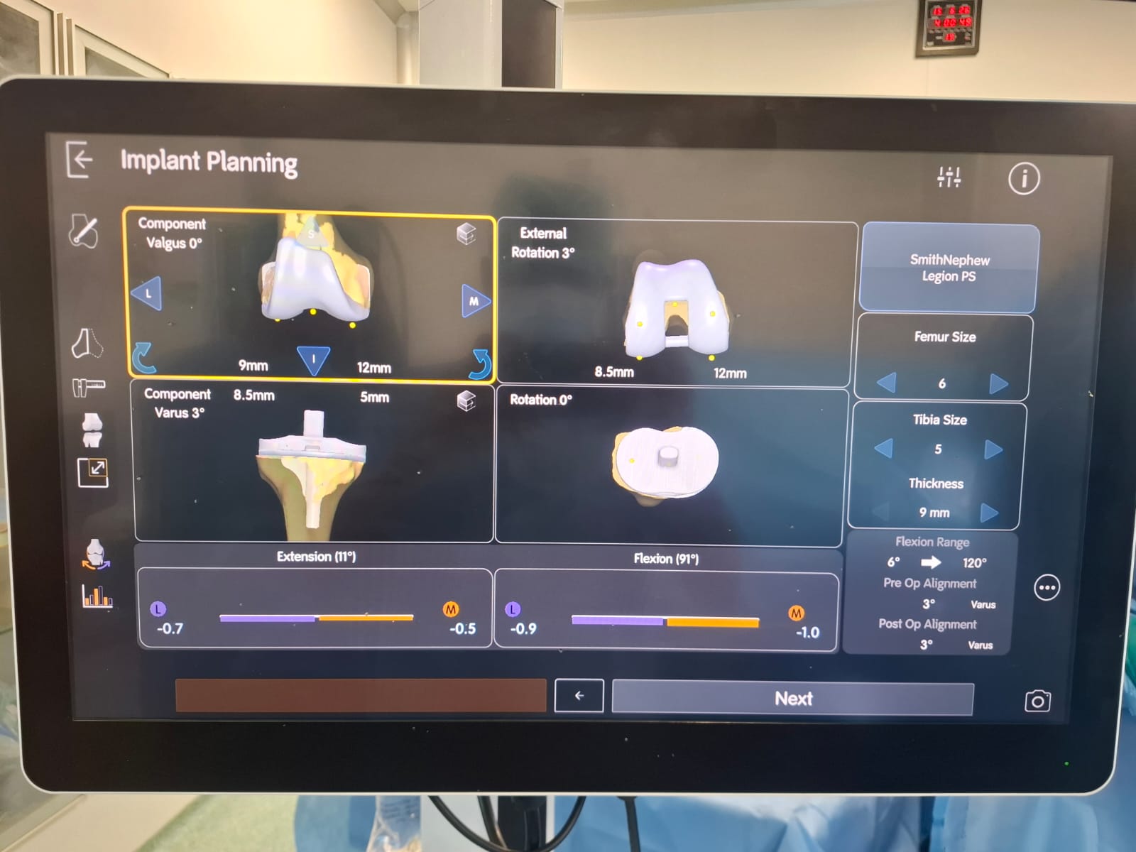 Knee X-ray 33