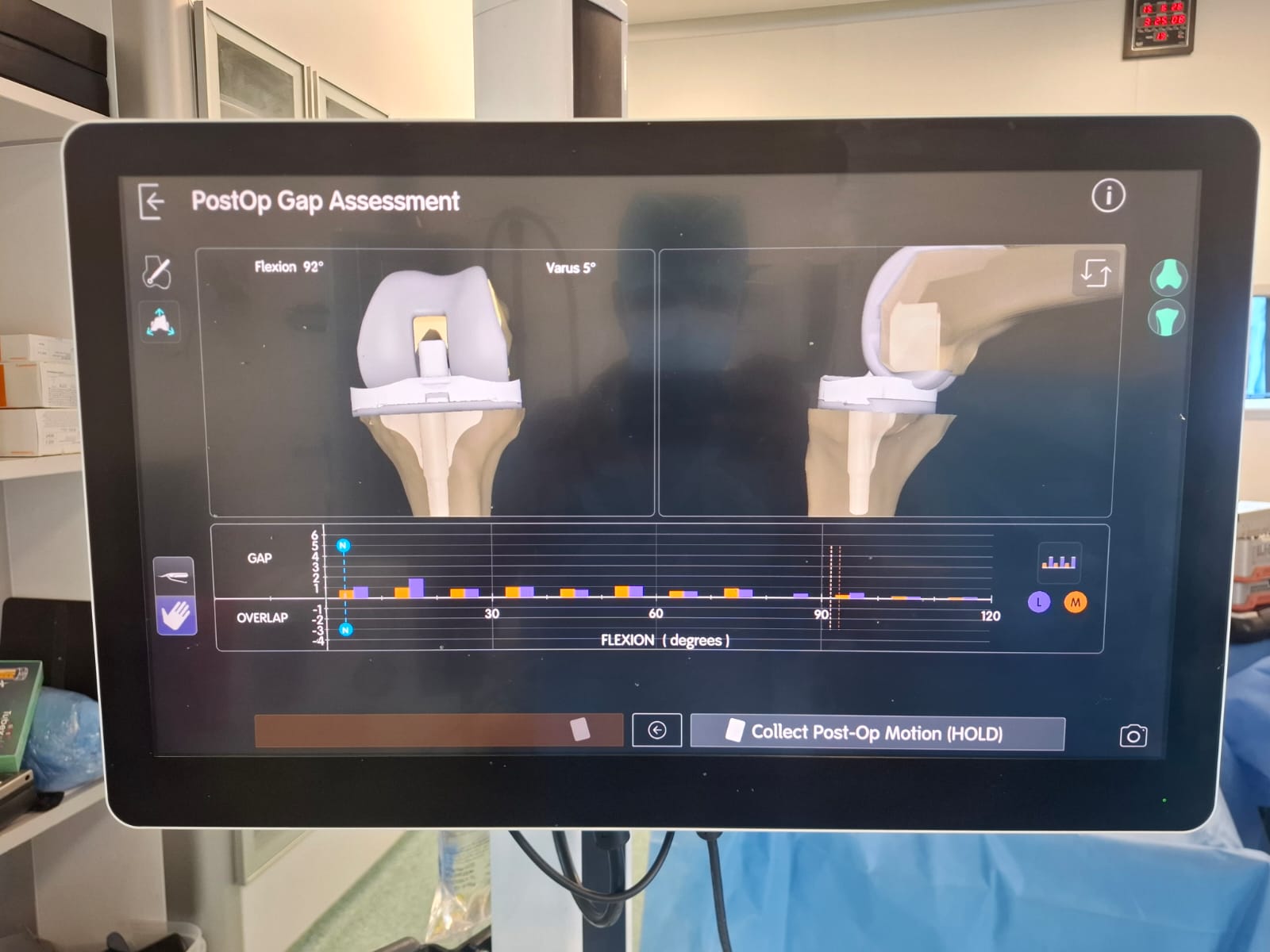 Knee X-ray 36