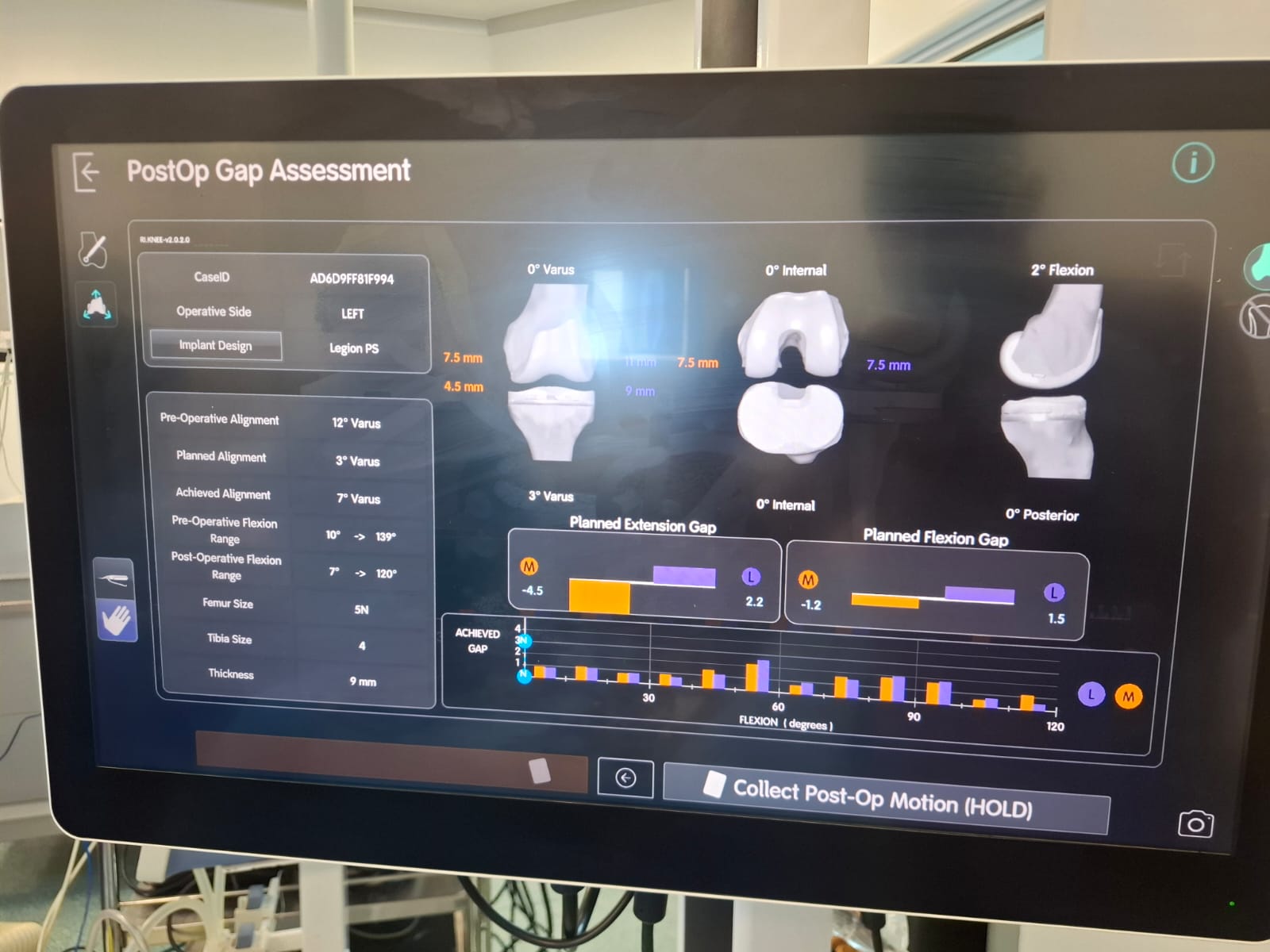Knee X-ray 39