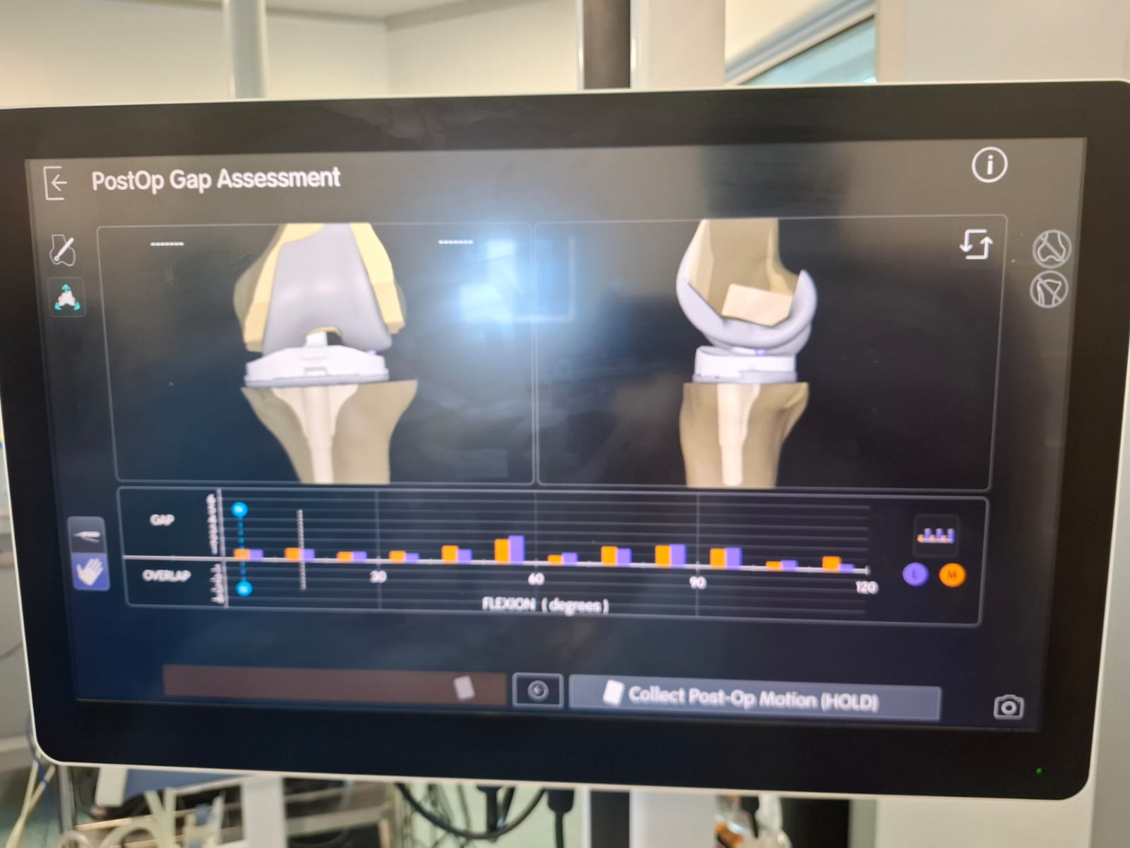 Knee X-ray 40