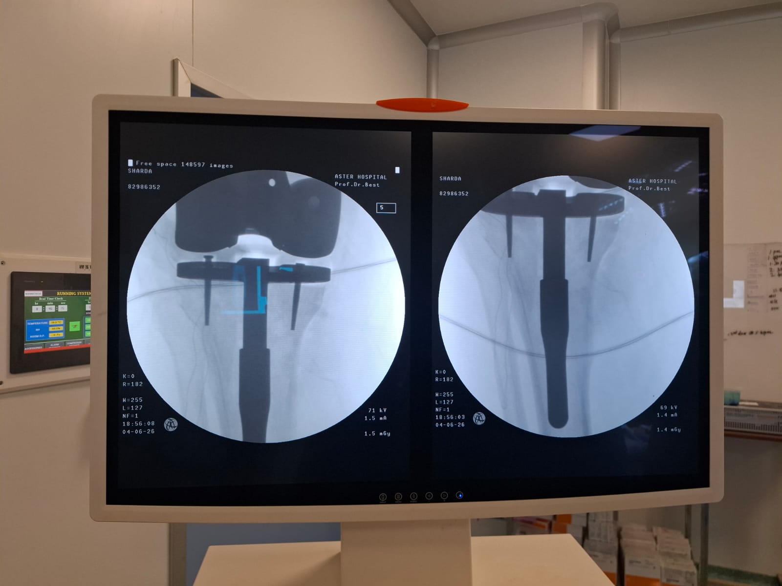 Knee X-ray 41