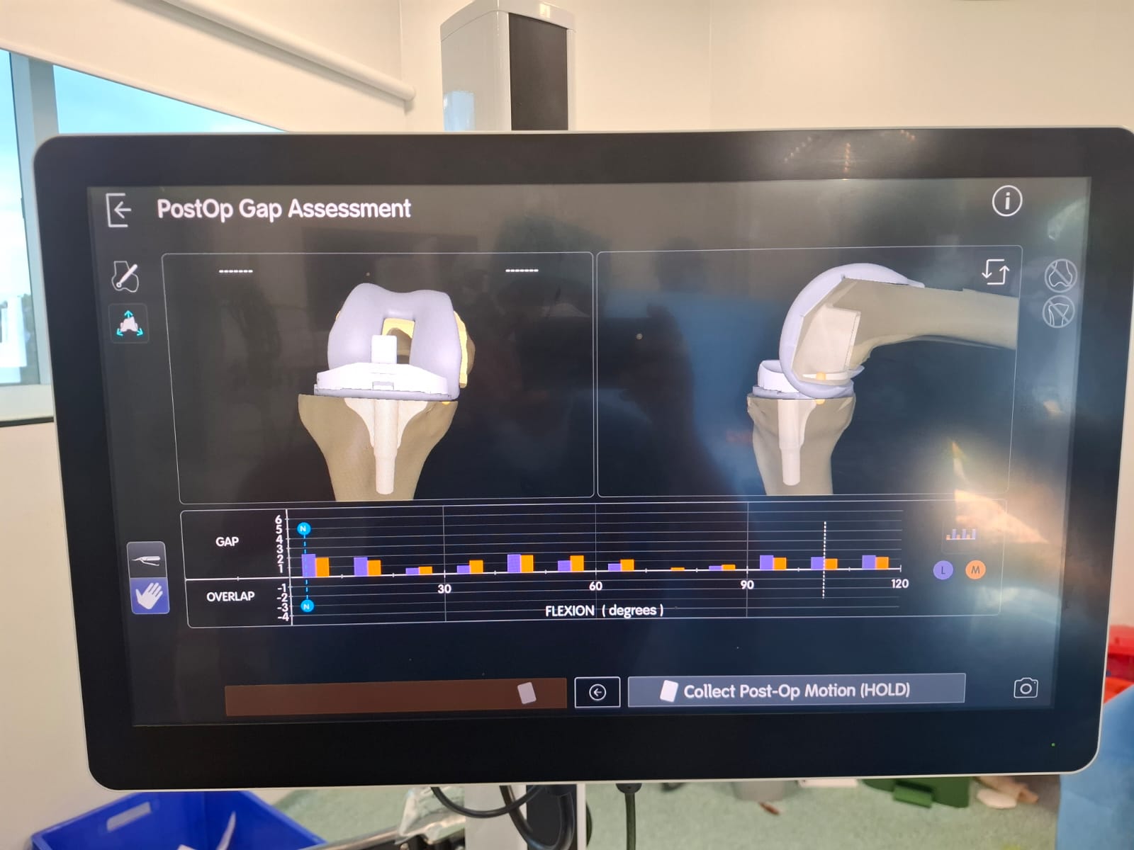Knee X-ray 44