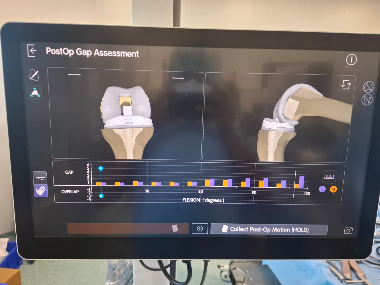 Knee X-ray 48