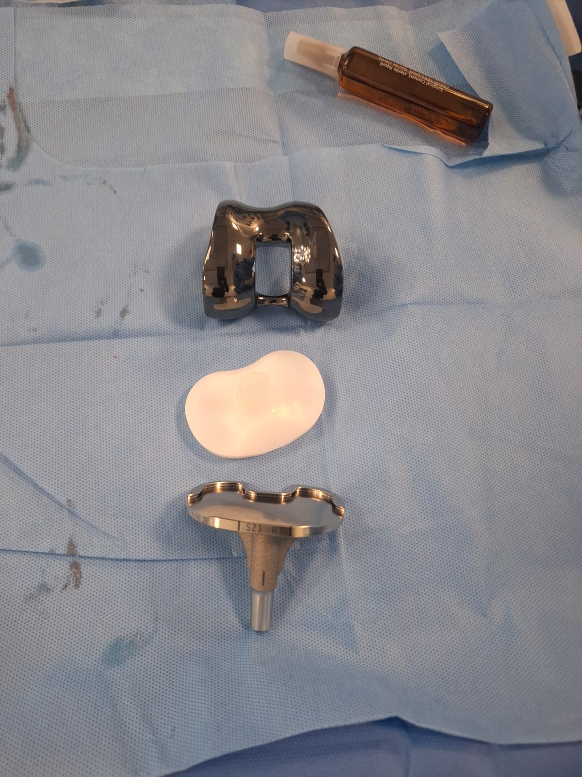 Knee X-ray 51