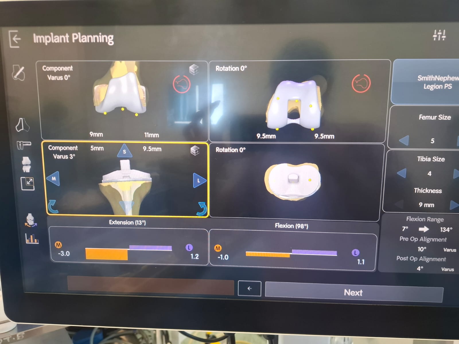 Knee X-ray 52