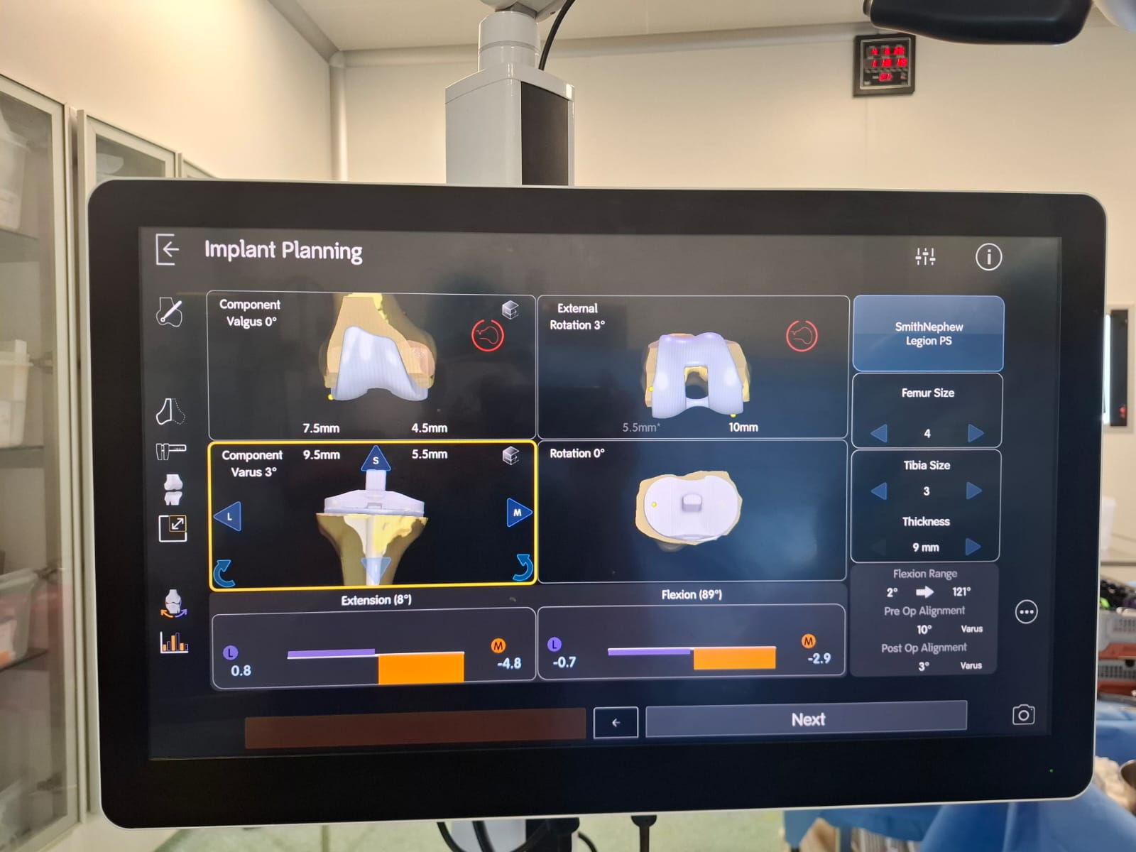 Knee X-ray 55