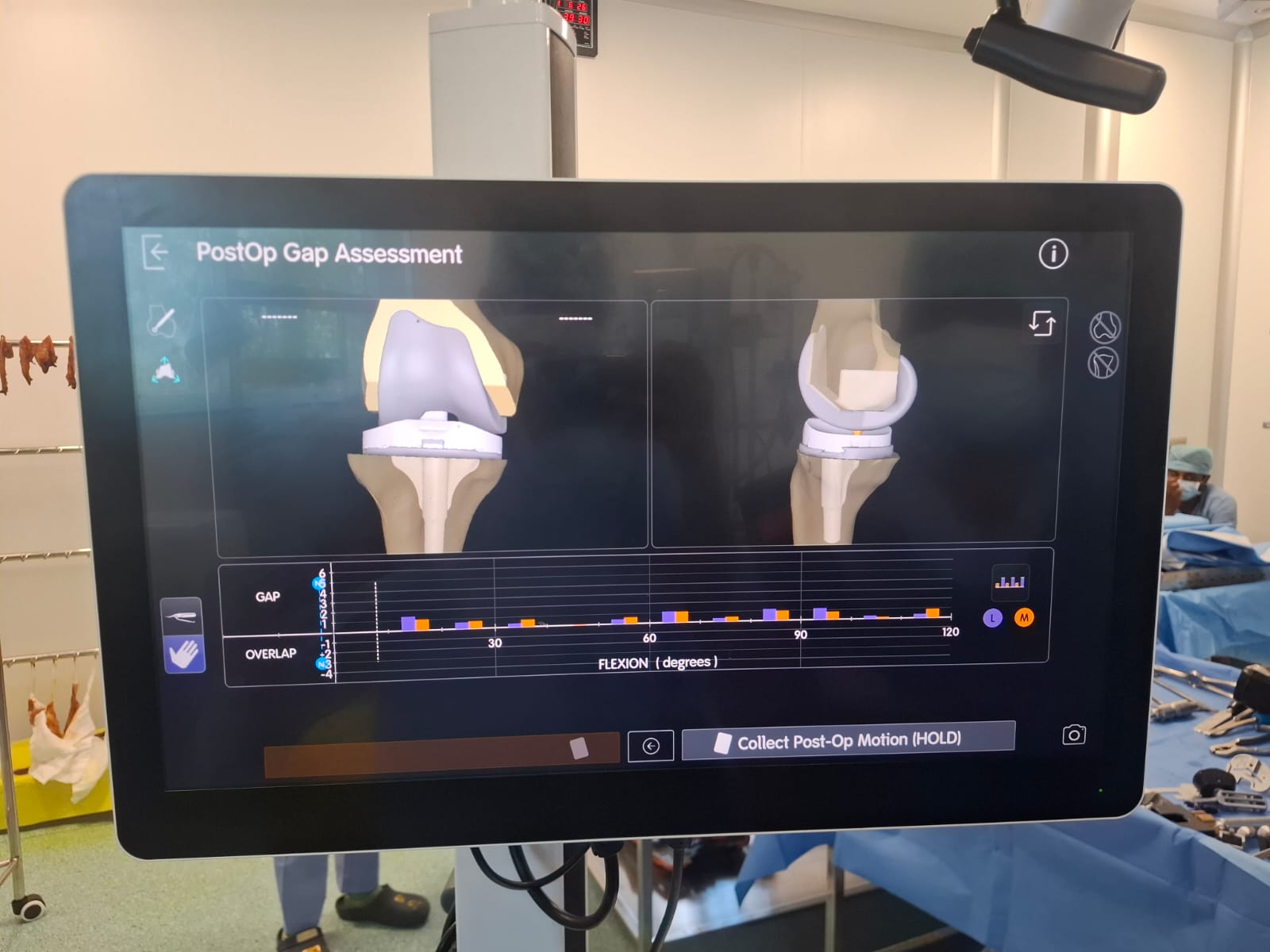 Knee X-ray 57