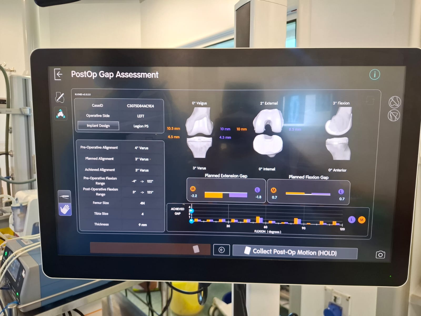 Knee X-ray 58