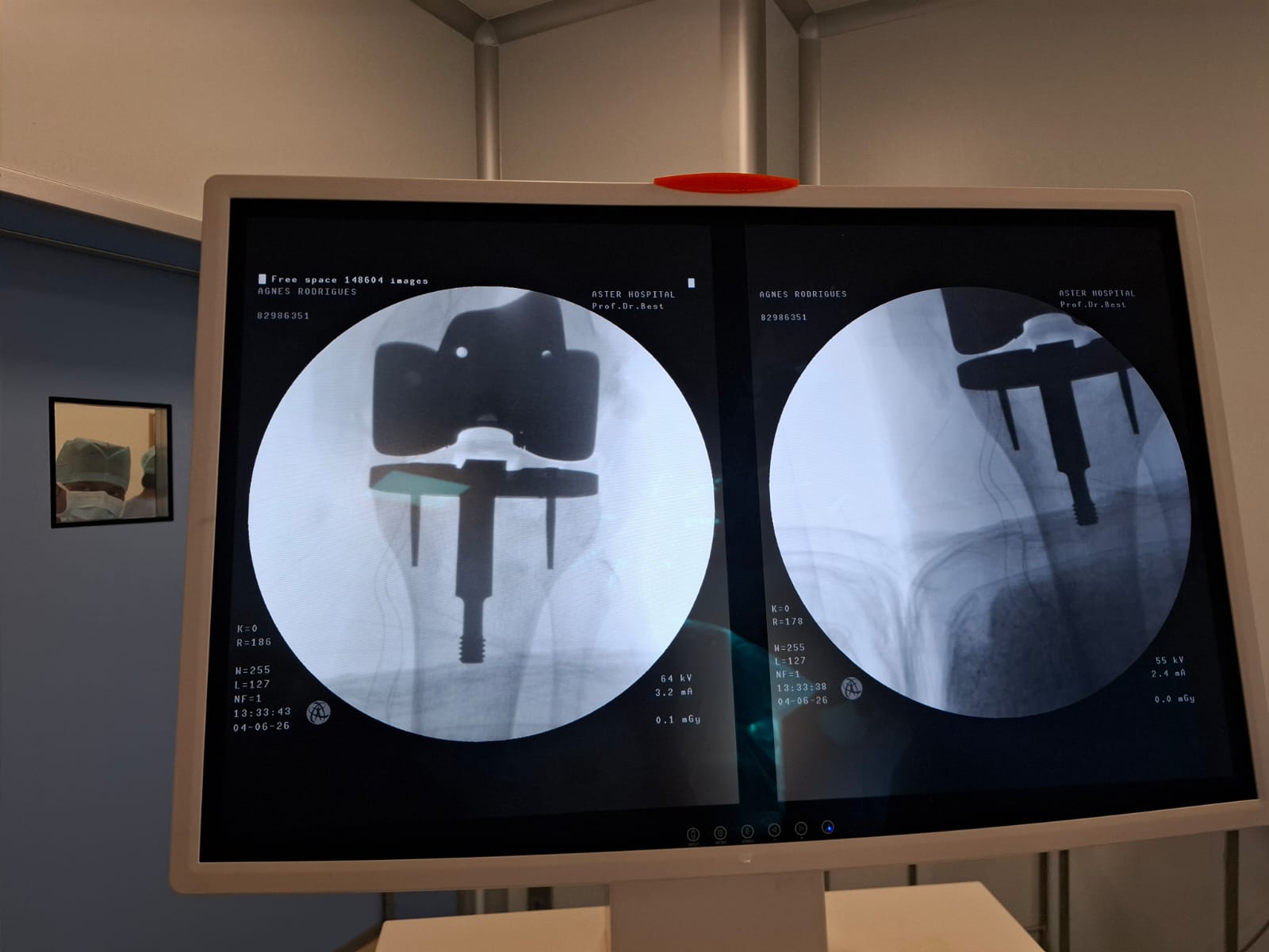 Knee X-ray 59