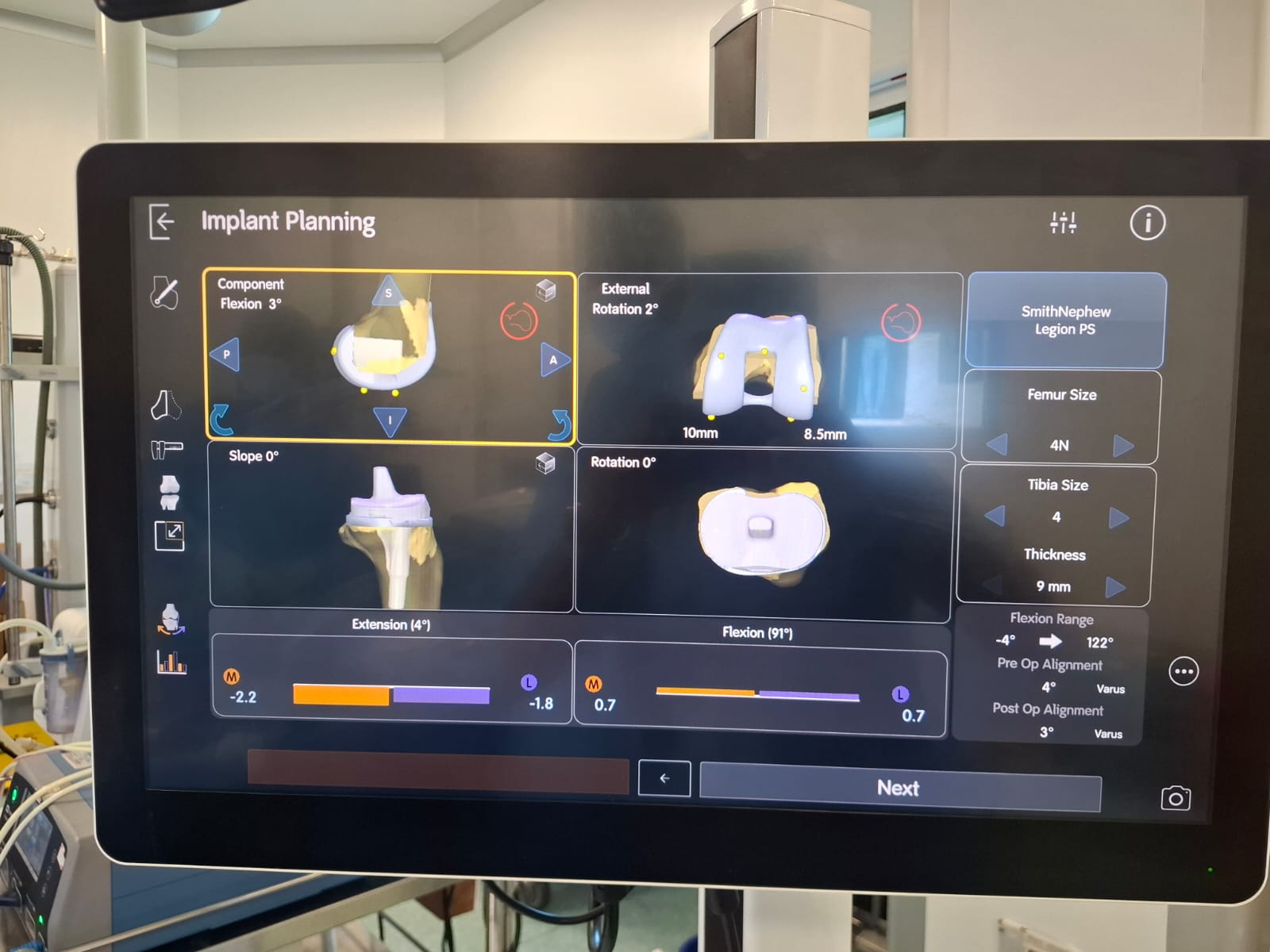 Knee X-ray 61