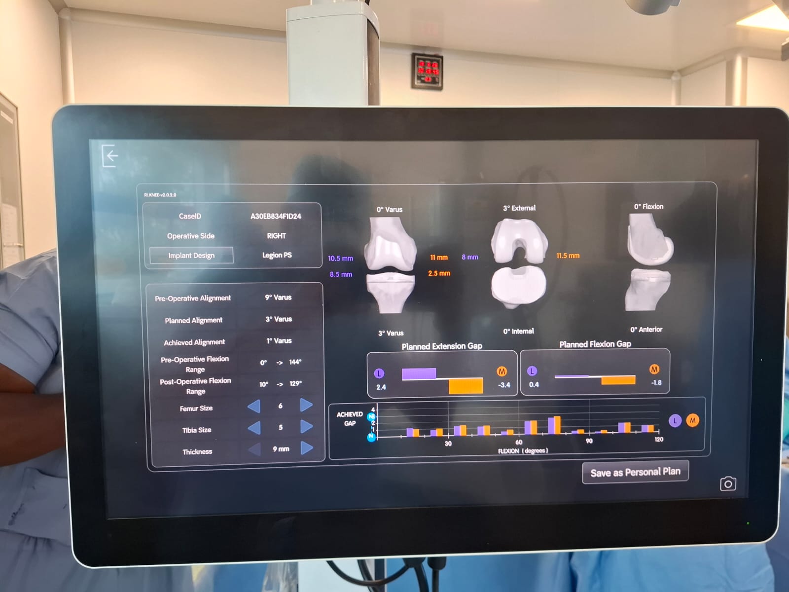Knee X-ray 69