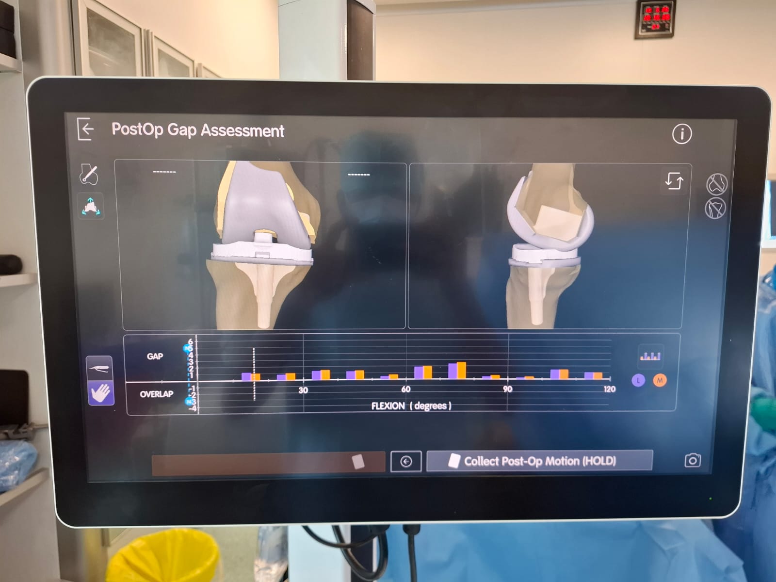 Knee X-ray 73