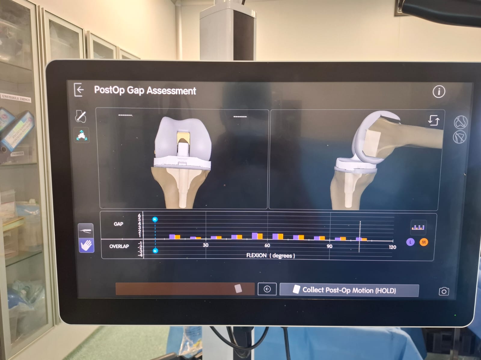 Knee X-ray 75