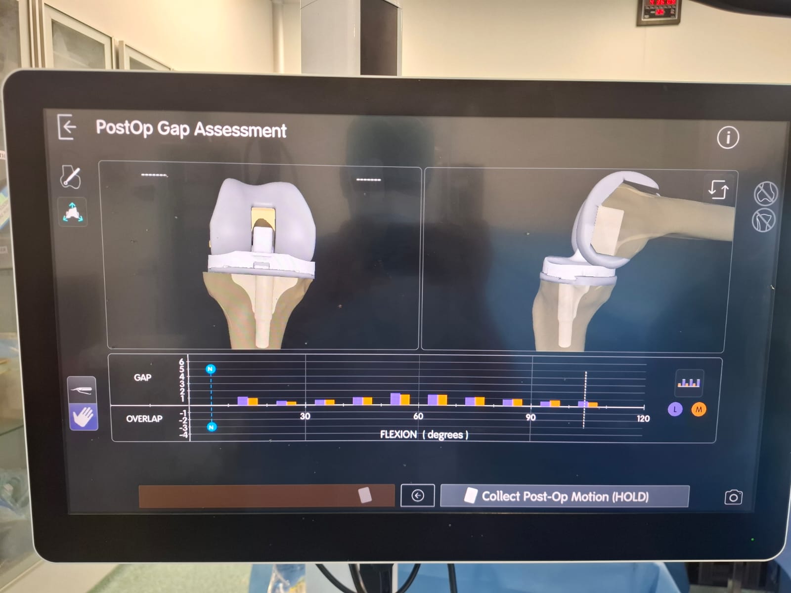 Knee X-ray 76