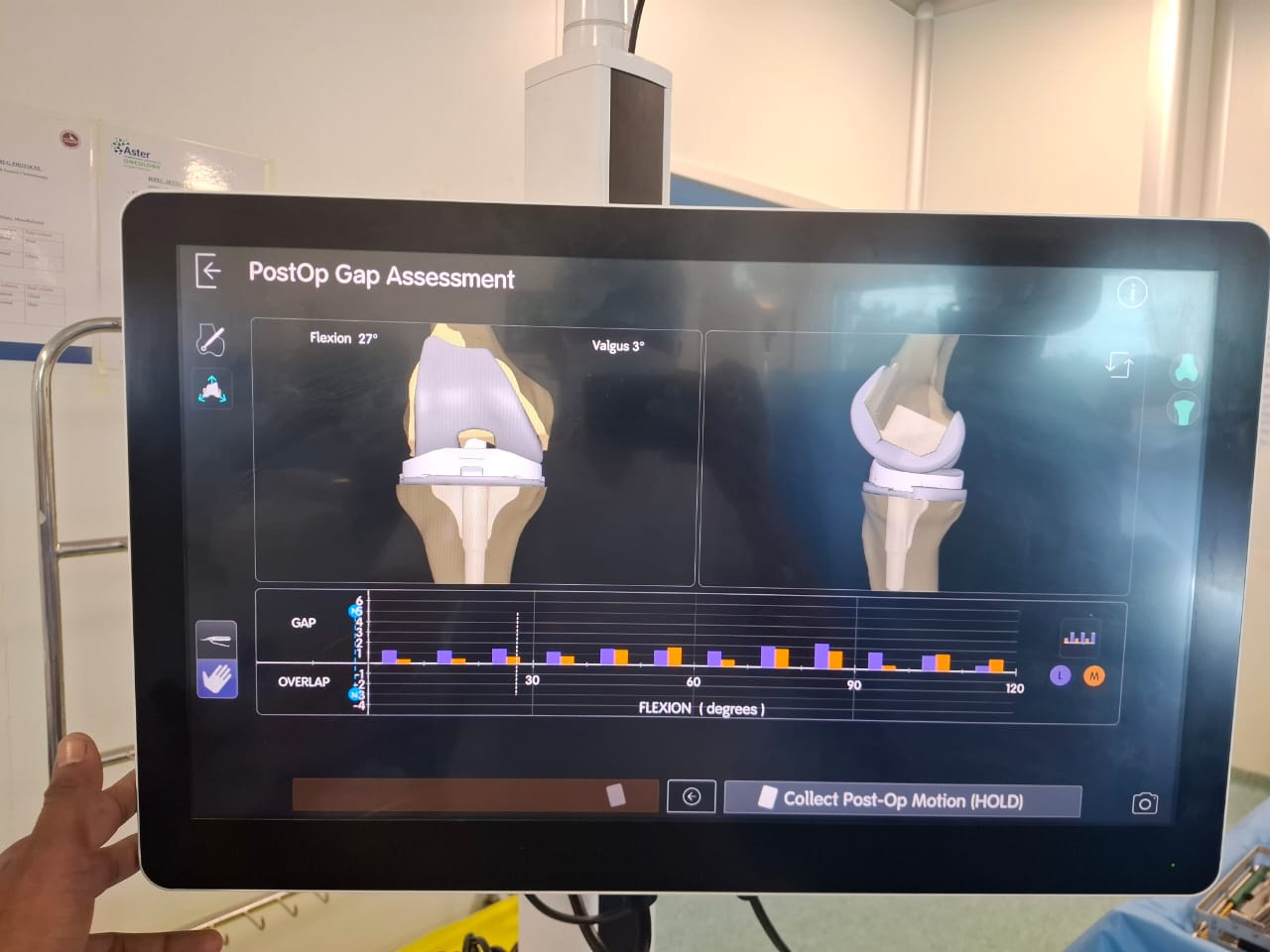 Knee X-ray 8