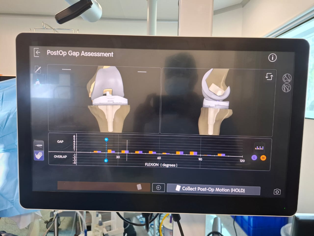 Knee X-ray 9
