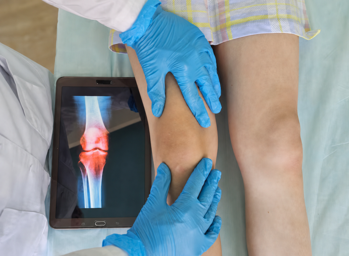 Orthopaedic knee examination and X-ray assessment in ITPL